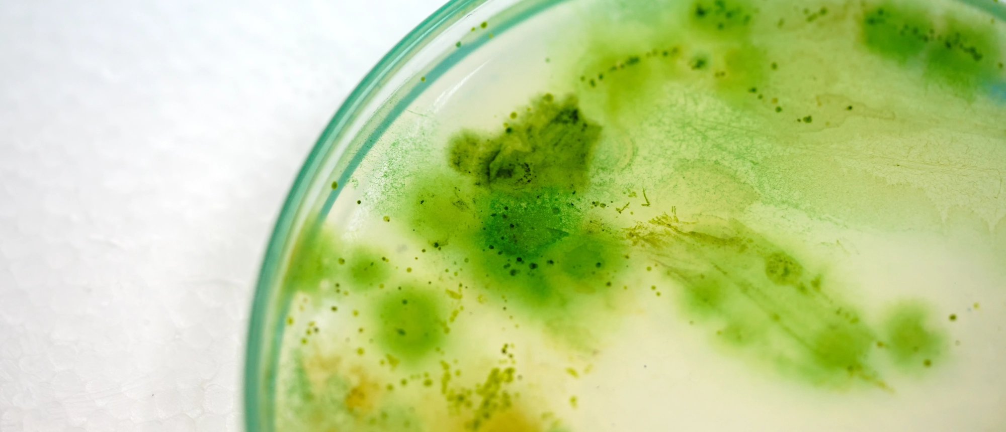 Legionella in drinking water - Mediagon