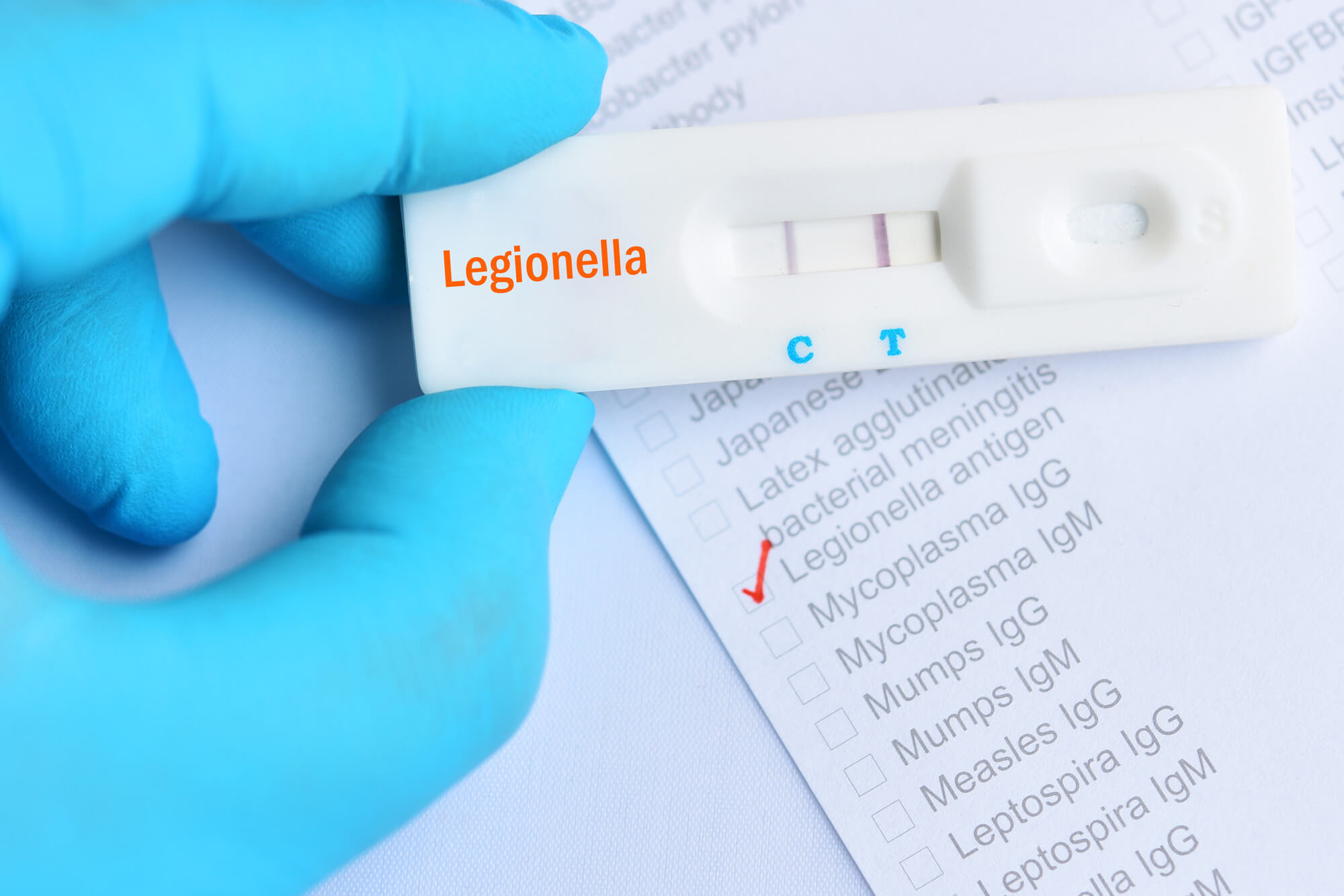 Bandelettes de test de légionellose